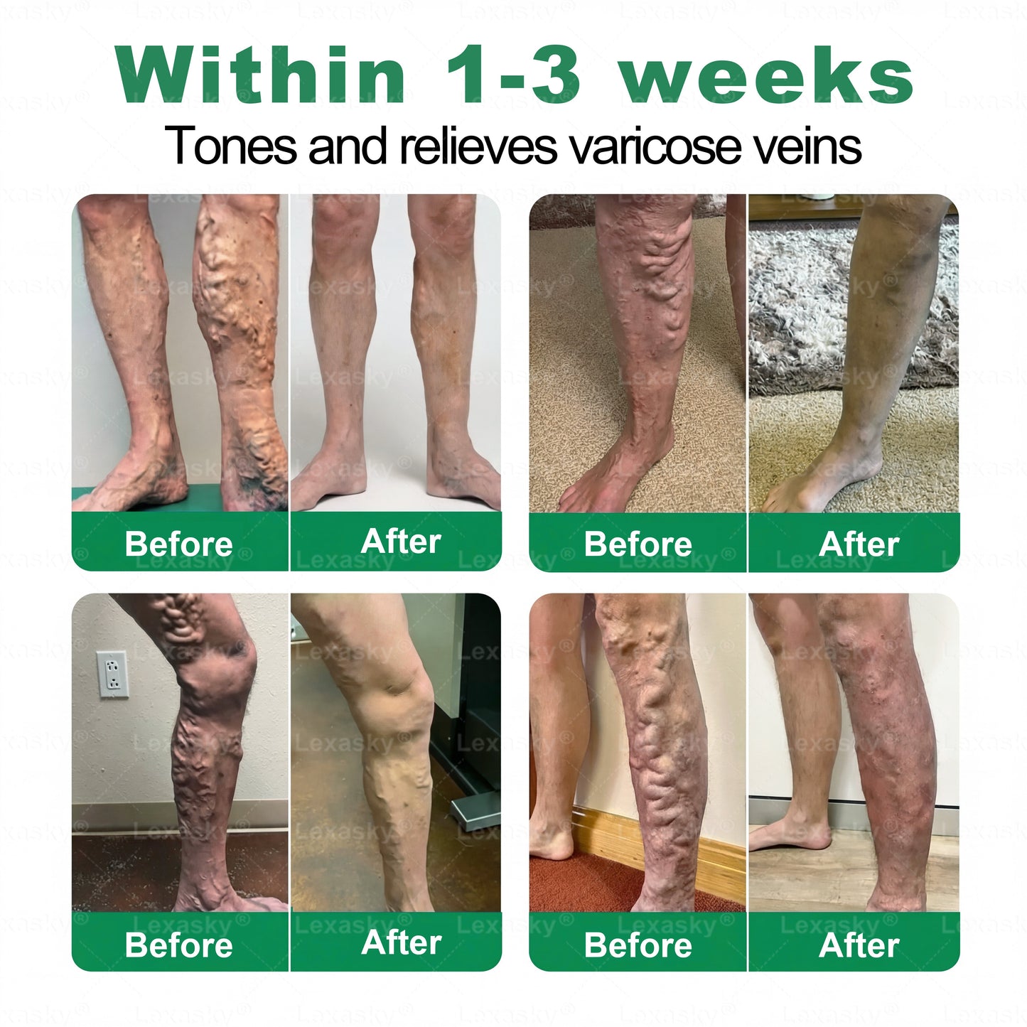 👨‍⚕️✅✅𝐋𝐞𝐱𝐚𝐬𝐤𝐲® 𝐕𝐞𝐢𝐧 𝐓𝐚𝐫𝐠𝐞𝐭 𝐌𝐢𝐜𝐫𝐨𝐧𝐞𝐞𝐝𝐥𝐞 𝐏𝐚𝐭𝐜𝐡 ⚡Instant Relief, Long-Term Results big sale