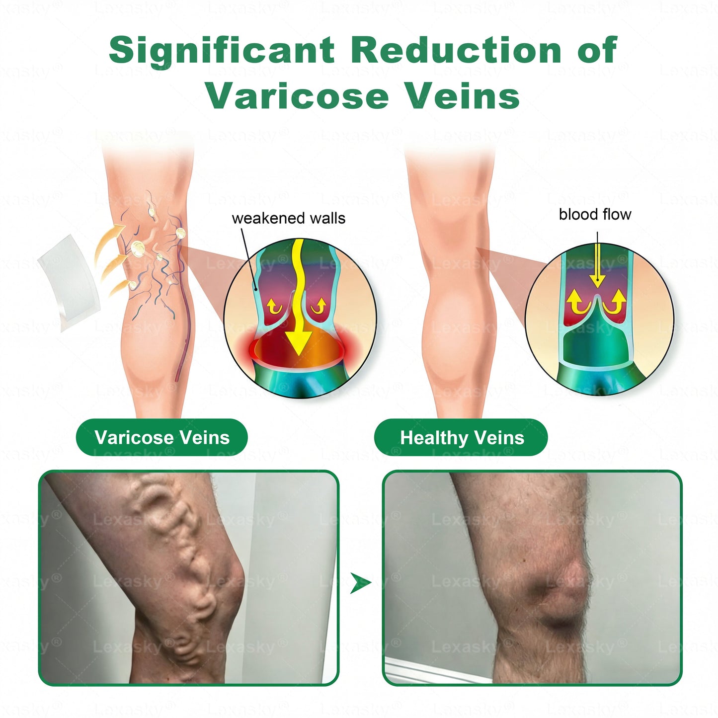 👨‍⚕️✅✅𝐋𝐞𝐱𝐚𝐬𝐤𝐲® 𝐕𝐞𝐢𝐧 𝐓𝐚𝐫𝐠𝐞𝐭 𝐌𝐢𝐜𝐫𝐨𝐧𝐞𝐞𝐝𝐥𝐞 𝐏𝐚𝐭𝐜𝐡 ⚡Instant Relief, Long-Term Results big sale